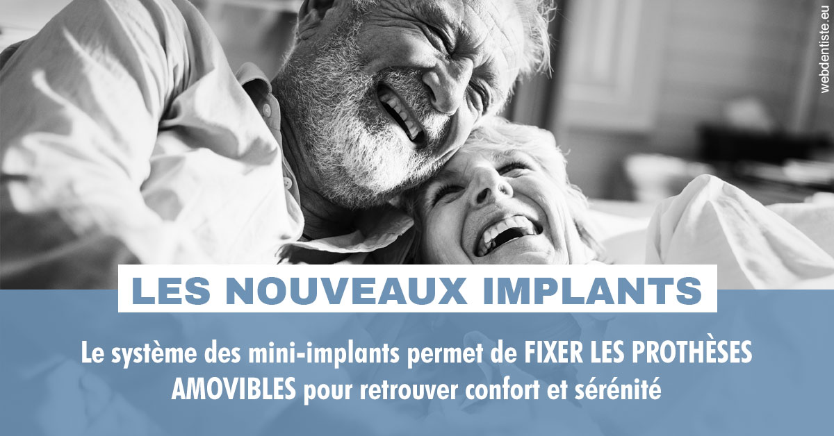 https://dr-surmenian-jerome.chirurgiens-dentistes.fr/Les nouveaux implants 2