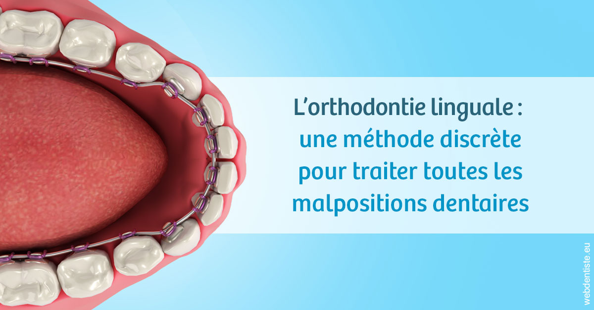 https://dr-surmenian-jerome.chirurgiens-dentistes.fr/L'orthodontie linguale 1
