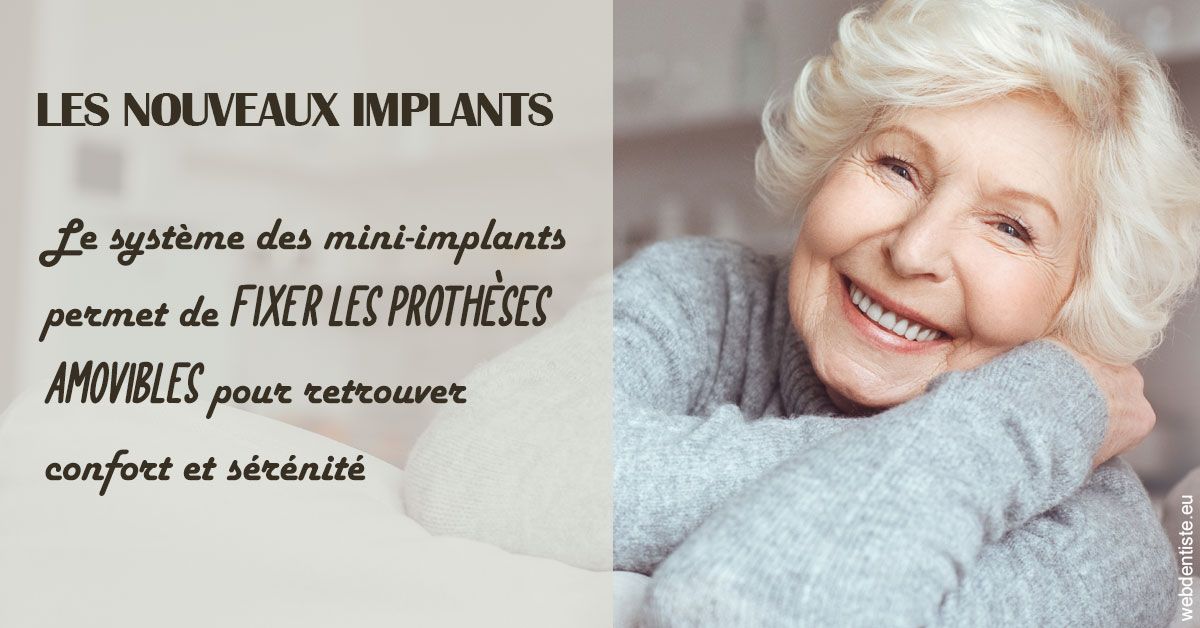 https://dr-surmenian-jerome.chirurgiens-dentistes.fr/Les nouveaux implants 1
