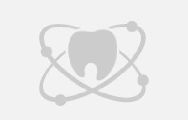 Pose d'implants dentaires à Nice