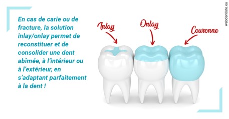 https://dr-surmenian-jerome.chirurgiens-dentistes.fr/L'INLAY ou l'ONLAY