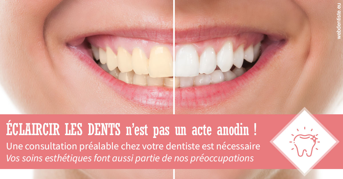 https://dr-surmenian-jerome.chirurgiens-dentistes.fr/Eclaircir les dents 1