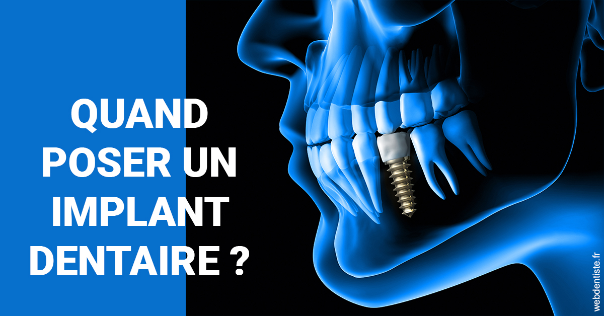 https://dr-surmenian-jerome.chirurgiens-dentistes.fr/Les implants 1