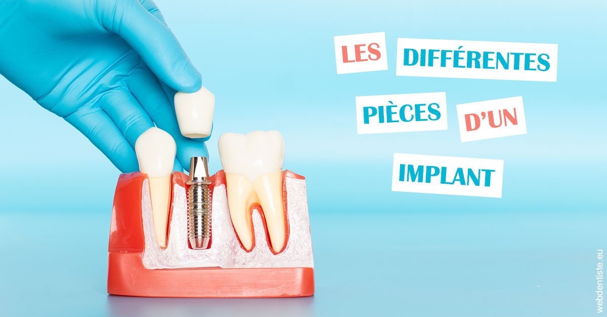 https://dr-surmenian-jerome.chirurgiens-dentistes.fr/Les différentes pièces d’un implant 2