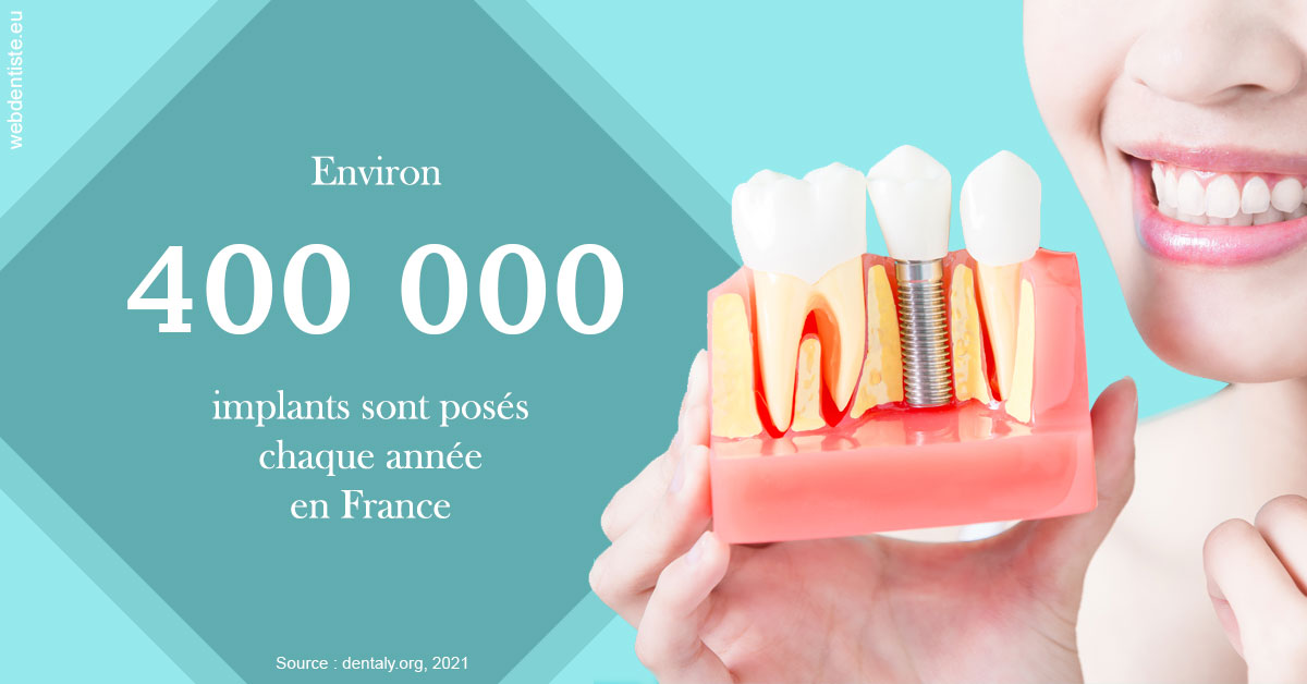 https://dr-surmenian-jerome.chirurgiens-dentistes.fr/Pose d'implants en France 2