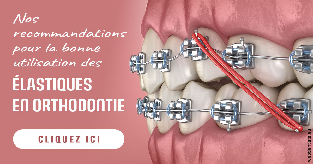 https://dr-surmenian-jerome.chirurgiens-dentistes.fr/Elastiques orthodontie 2